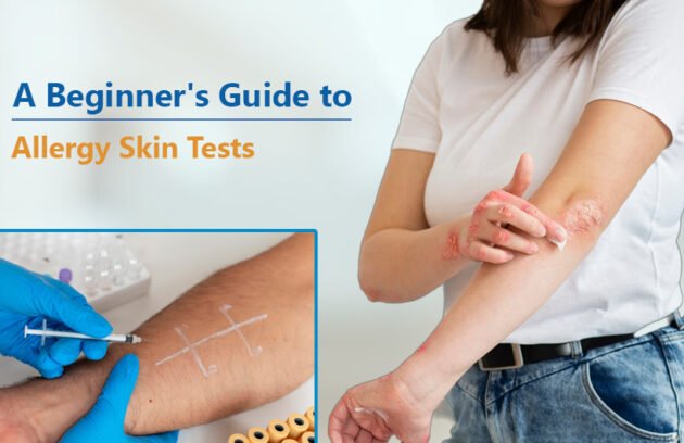 beginner's guide to allergy skin tests