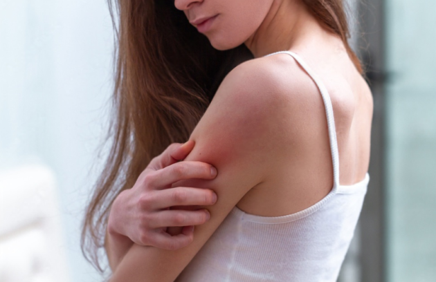 understanding allergy skin testing: a comprehensive overview