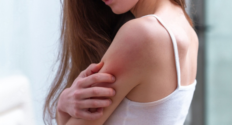 understanding allergy skin testing: a comprehensive overview