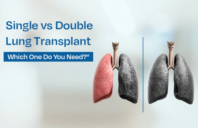 Single vs Double Lung Transplant