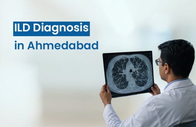 ILD Diagnosis in Ahmedabad