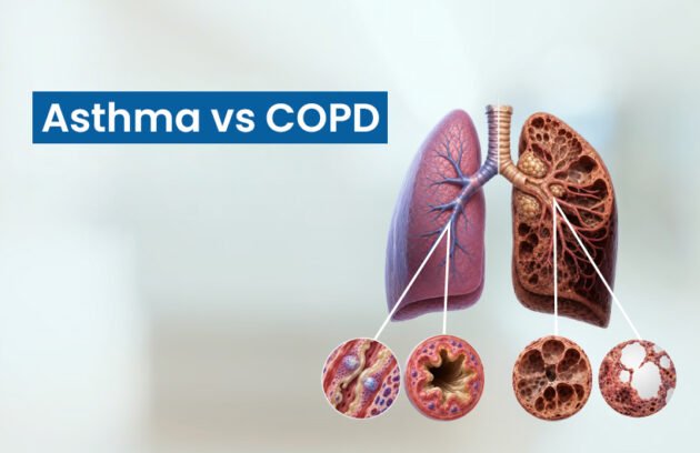 Asthma vs COPD