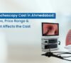 Bronchoscopy Cost in Ahmedabad