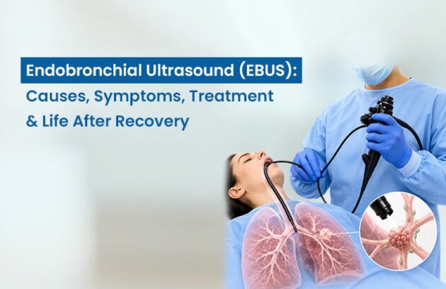 Endobronchial Ultrasound (EBUS)