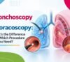 Bronchoscopy vs Thoracoscopy