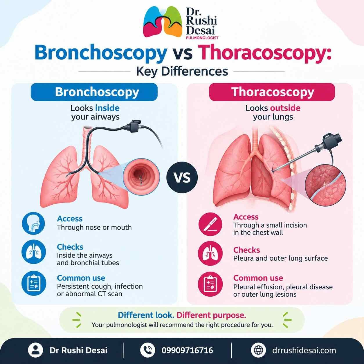 Bronchoscopy vs Thoracoscopy Key Differences