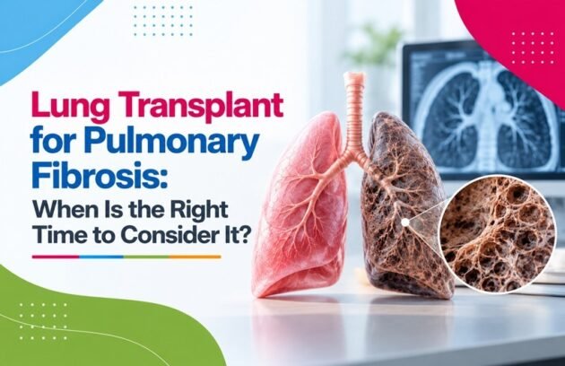 Lung Transplant for Pulmonary Fibrosis