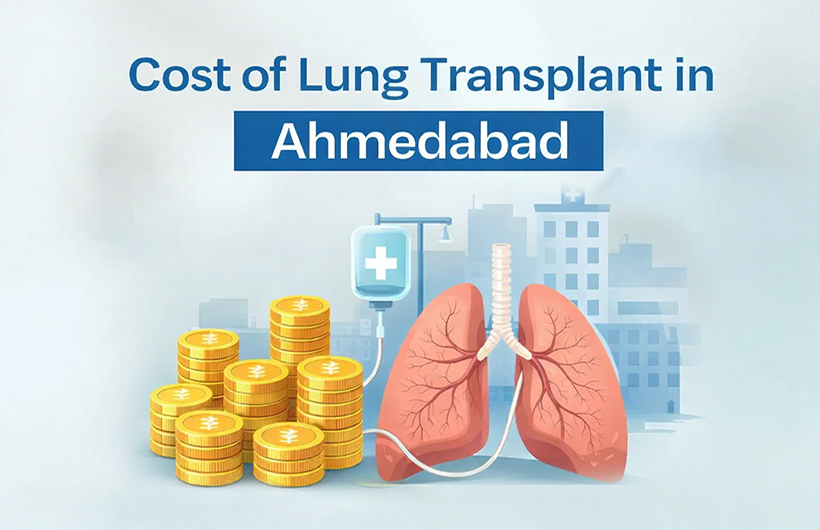 Cost of Lung Transplant in Ahmedabad