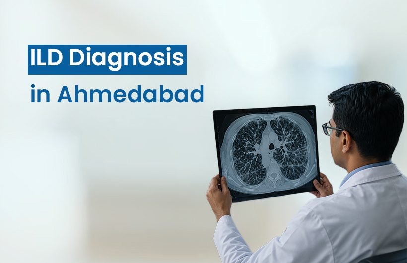 ILD Diagnosis in Ahmedabad