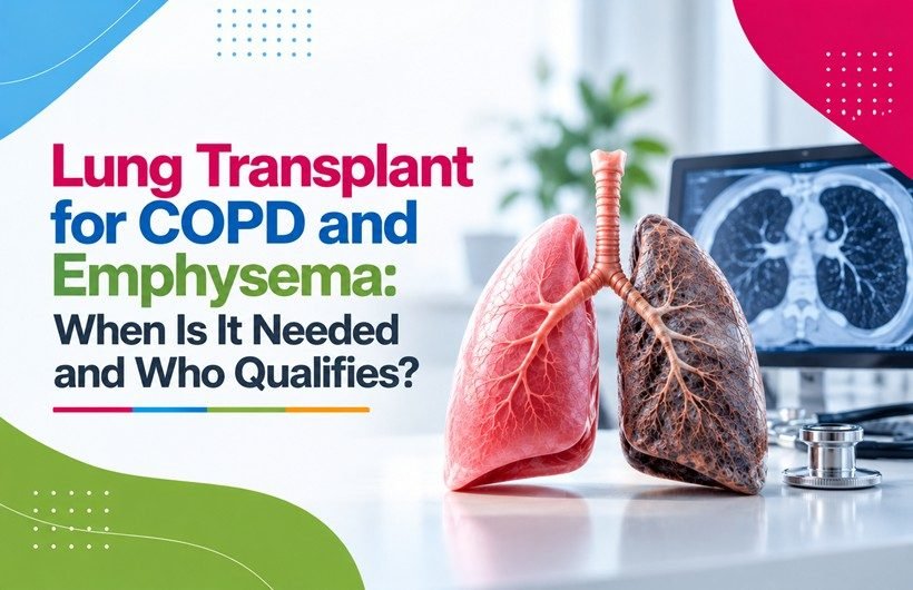 Lung Transplant for COPD