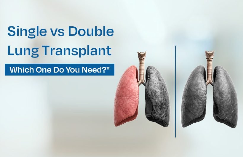 Single vs Double Lung Transplant