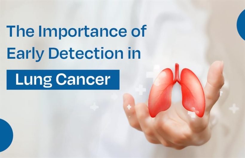 lung cancer treatment