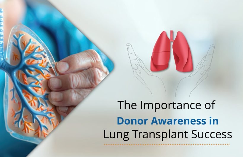 lung transplant